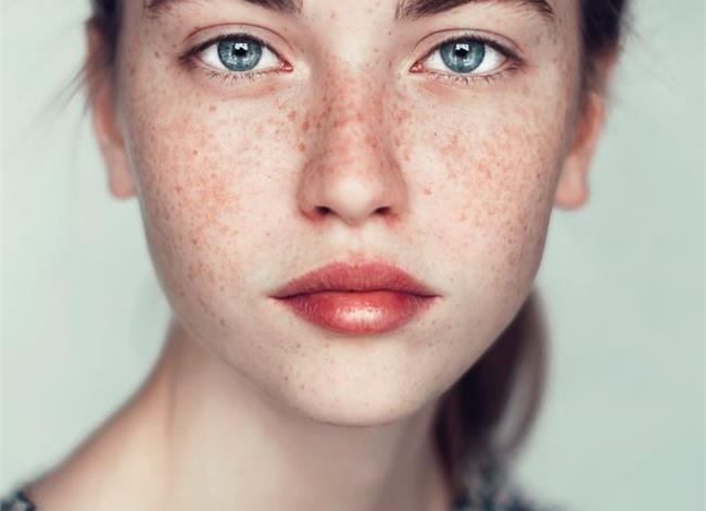Skin Positivity: Tο κίνημα αποδοχής των ατελειών μας Skin Positivity: Tο κίνημα αποδοχής των ατελειών μας